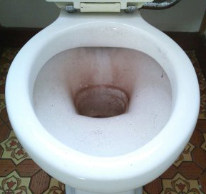 新横浜:港北区篠原町Kアパートトイレ清掃前